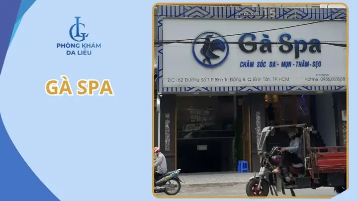Gà Spa Trị Mụn Tốt Không? Review Chi Tiết, Quy Trình, Giá Cả & Kinh Nghiệm Thực Tế Năm 2026