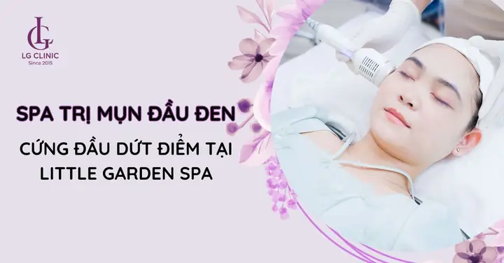 Bảng Giá Hút Mụn Đầu Đen Tại Spa Năm 2026: Chi Phí, Quy Trình & Kinh Nghiệm Chọn Địa Chỉ Uy Tín