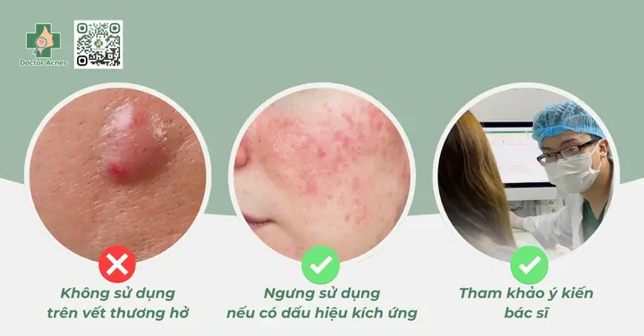 Hút Mụn Có Tác Dụng Gì? Toàn Tập Lợi Ích, Quy Trình, Chi Phí Và Lưu Ý Quan Trọng Năm 2026
